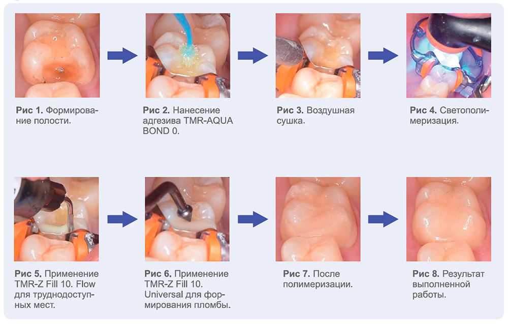 Ямакинтамзефилл9